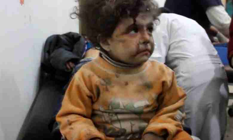 Lief meisje uit Aleppo. Ik schaam me dood voor deze wereld
