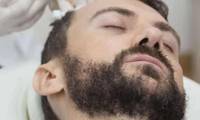 Mijn Krijgt Haartransplantatie